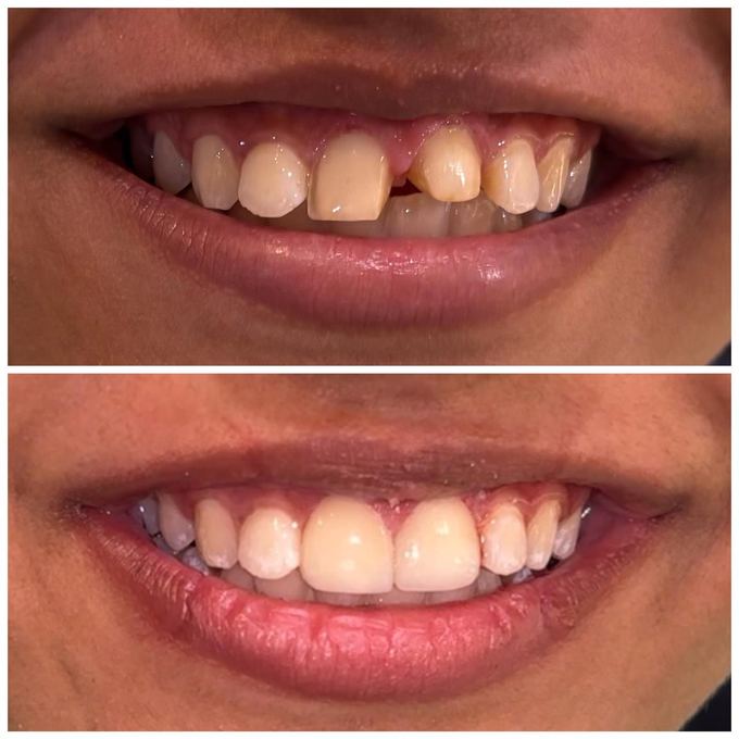 Cosmetic Dentistry Before and After at The Oral Edit
