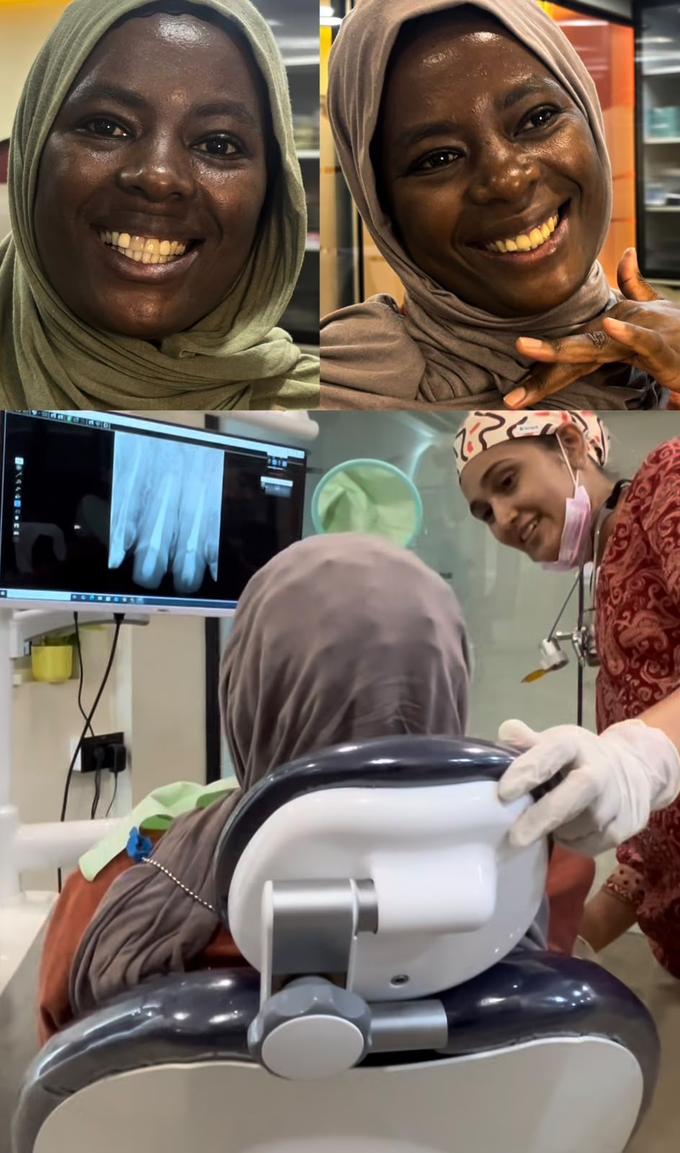 Smile Designing Result at The Oral Edit